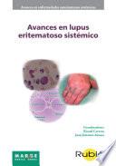 Libro Avances en lupus eritematoso sistémico