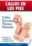 Libro CALLOS EN LOS PIES - Solución definitiva para Callos, Tilomas y Helomas.