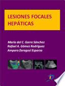 Libro Lesiones focales hepáticas