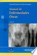 Libro Manual De Enfermedades Oseas / Bone Diseases Manual